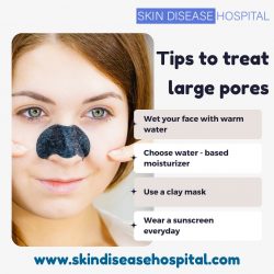Tips to treat large pores