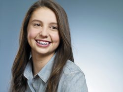 Braces for Teens – Bellevue Orthodontics & Smile Design