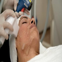 Get Anti Ageing Scarring Treatment