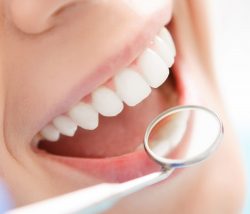 Professional Teeth Whitening Near Me | Teeth Whitening Houston TX