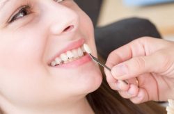 Porcelain Veneers – The Center for Cosmetic Dentistry