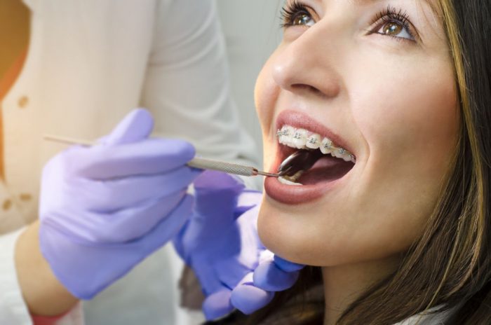 Find The Best Orthodontist In Miami Fl | Teeth Braces in Miami – Pediatric Dental Associates