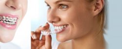 Miami Center for Cosmetic and Implant Dentistry: Miami Dentist