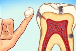 How to treat toothache | Toothache Treatment | Toothache Cure