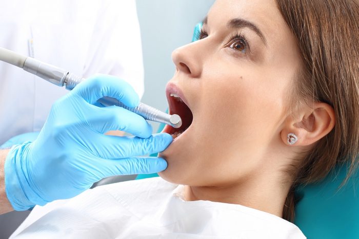 How Long Is Recovery From a Root Canal?