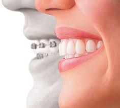 Orthodontic Specialists Of Florida |Seeing Our Top Orthodontist Specialist of Florida