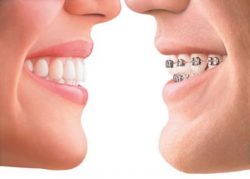 Orthodontic Specialists of Florida – Orthodontics Specialist Of Florida