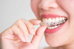 Seeing Our Top Orthodontist Specialist of Florida |Orthodontics Specialists Of Florida
