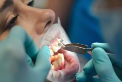 Best Orthodontist Specialists in Miami, Fl | Miami Orthodontic Specialists | Orthodontist in Miami