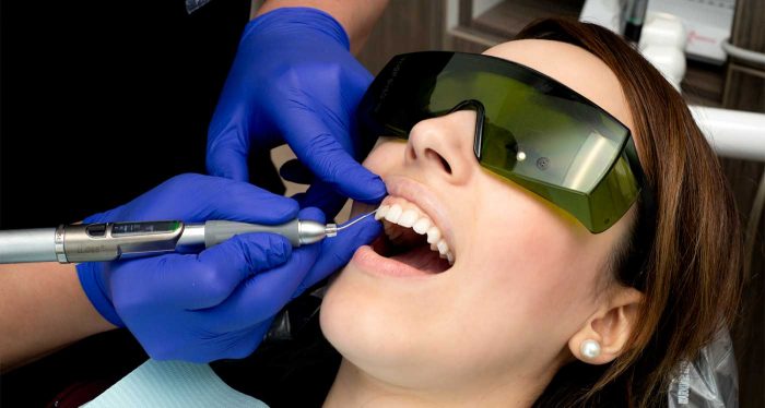 Laser Dentistry Near Me | LANAP Laser Dentist in Houston TX