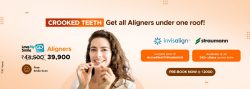 Crooked Teeth Get All Aligners Under One Roof