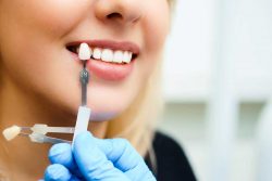 Affordable Dental Implant Specialist in Houston