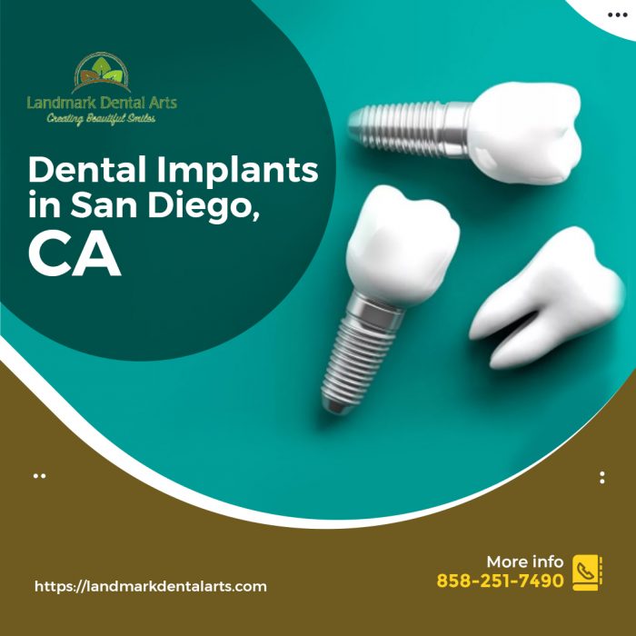 Avail The Best Dental Implants in San Diego, CA – Landmark Dental