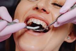 Teeth Whitening Lancaster PA