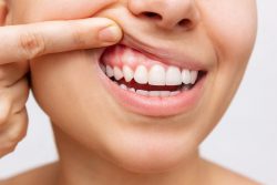How To Get Healthy Gums Fast | Types of Gum Disease