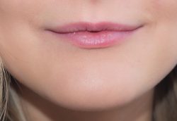 Get Rusted Lip Enhancement or Lip Flip in Ottawa – The Aesthetic Lounge