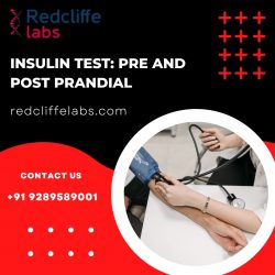 Insulin test: Pre and Post Prandial