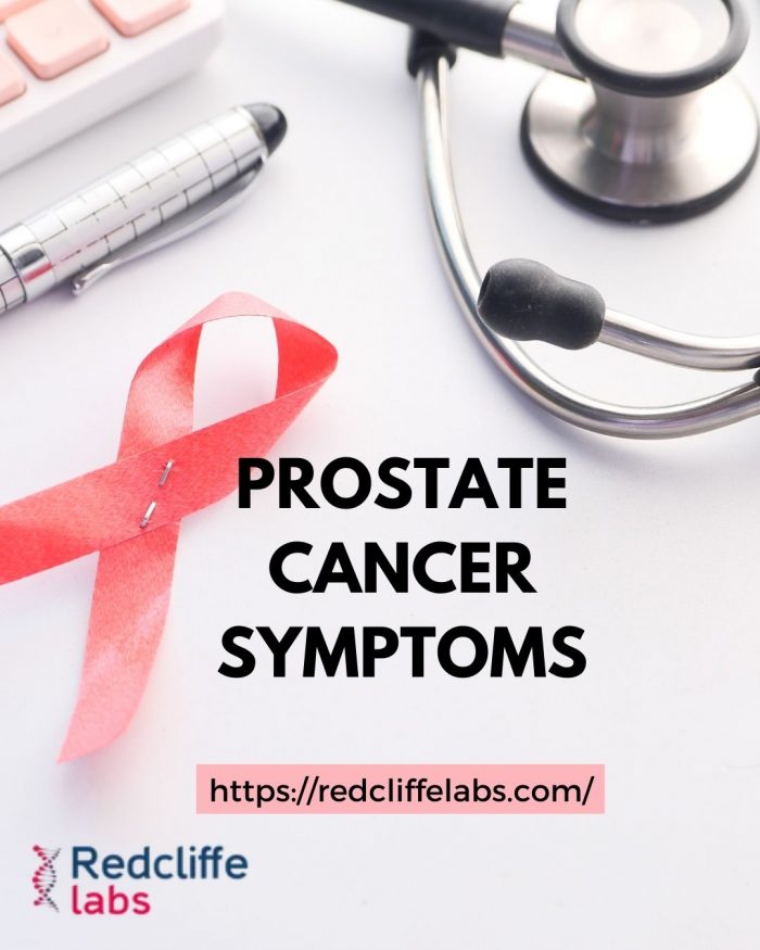 Prostate Cancer: symptoms, causes, and treatment – MyHealth