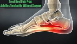 How and when to Treat Plantar Fasciitis-Related Heel Pain