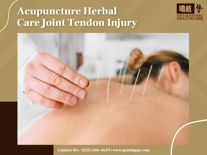 Acupuncture Herbal Care Joint Tendon Injury