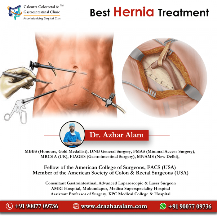 Hernia Doctor in Kolkata | Best Hernia Specialist Surgeon
