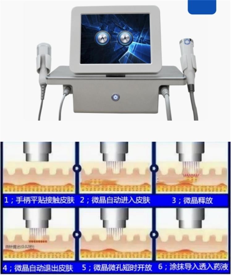 Gold RF microneedling Social Social Social Social Social Social