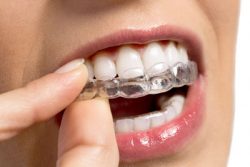 Invisalign Orthodontics – Miami
