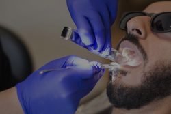 Tooth Extraction Houston |Where to Get Emergency Tooth Extraction?