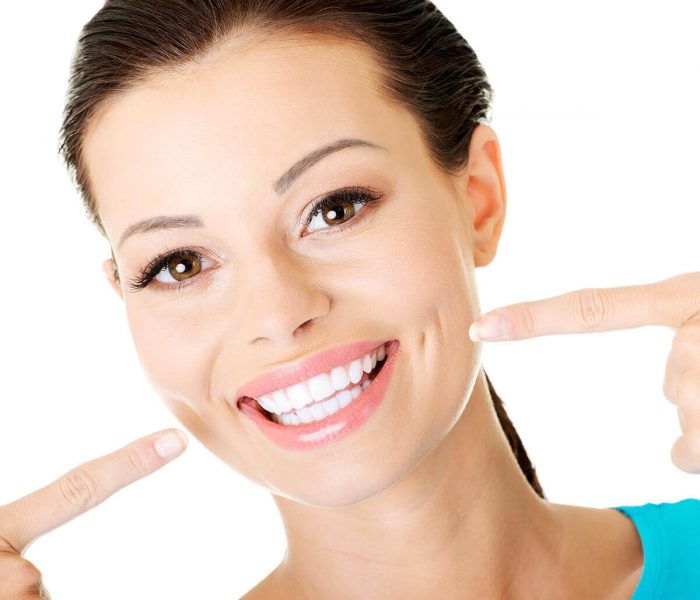 Traditional dental veneers |What Are Dental Veneers? Cost, Procedure & Advantages