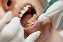 Laser Dentistry Near Me In Houston | Houston, TX Cosmetic Dentist