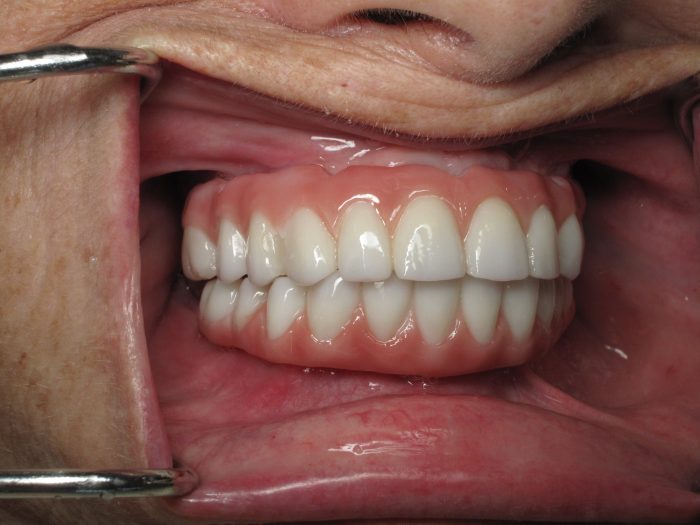 Cosmetic Dental Implants In Houston Tx |Cosmetic Dental Care – Cosmetic Dentistry