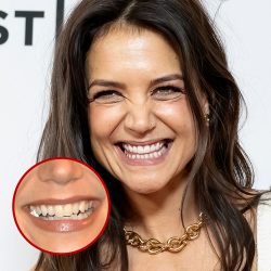 hollywood stars and veneers ( before and after )