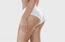 What Is a Brazilian Butt Lift? Procedure, Cost, and Recovery