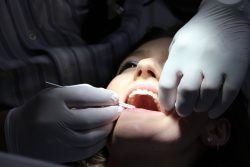 What is Laser Dentistry? | Laser Teeth Whitening