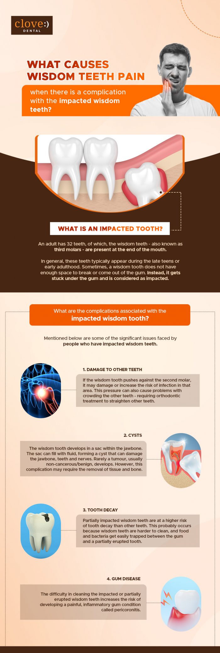What Causes Wisdom Teeth Pain