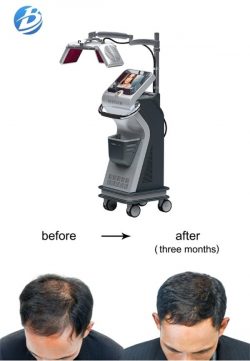 Laser hair regrowth machine