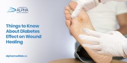 Everything To Know Diabetes Effect On Wound Healing