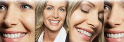 Same Day Dentures Before And After Process | Extractions & Immediate Dentures