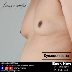 Gynecomastia Surgery In Delhi