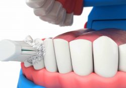 What Are The Advantages Of Deep Cleaning Teeth | The Benefits of Deep Cleaning Teeth