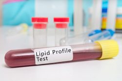 Why Should You Get A Lipid Profile Test At Home?