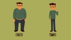 Liposuction Surgery Cost in Jaipur