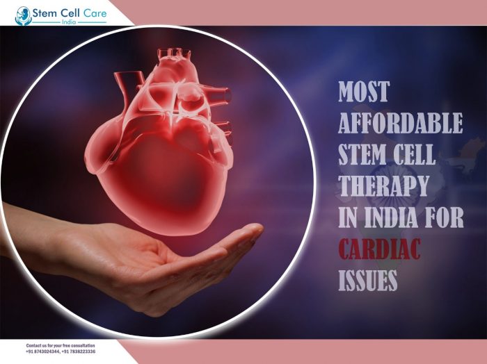 Most Affordable Stem Cell Therapy In India For Cardiac Issues