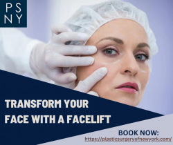 Book Now: The Best Facelift Services in NYC