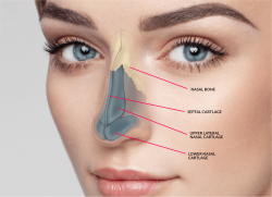 Nose Plastic Surgery Near Me | Rhinoplasty Surgery For Nose