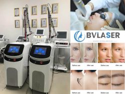 Picosure laser machine Harm and effect of picosecond laser freckle removal