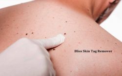Bliss Skin Tag Remover Reviews : Shocking Negative Reviews? See This Now!
