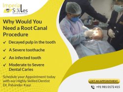 Why Would you Need a Root Canal Procedure?