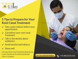 5 Tips to Prepare for Your Root Canal Treatment