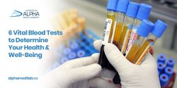 6 Vital Blood Tests To Determine Your Health & Well-Being